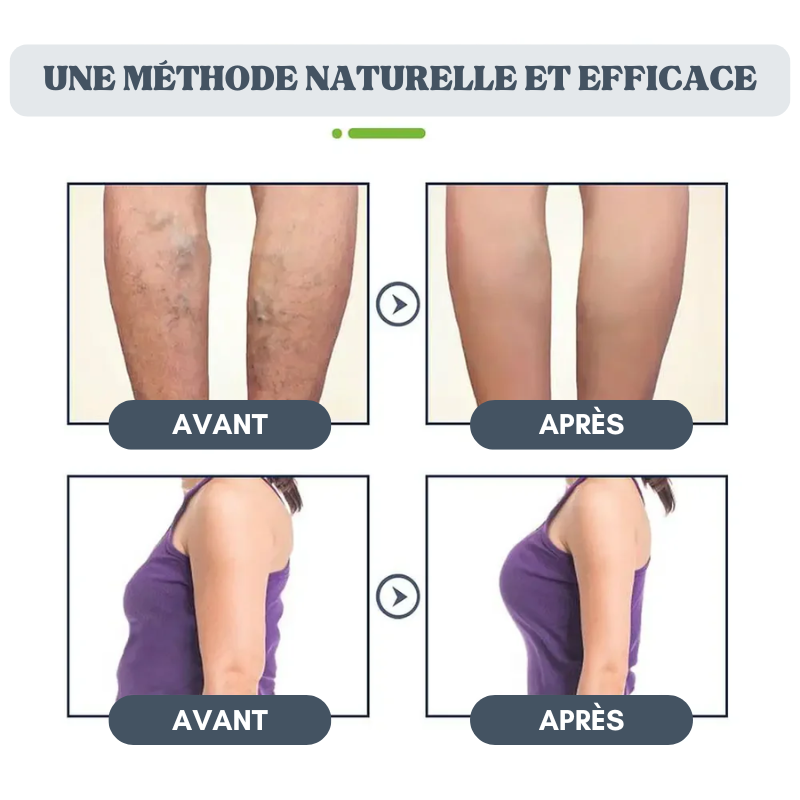 10x Capsules Bain de Pieds Lymphatiques 18 Plantes Naturelles