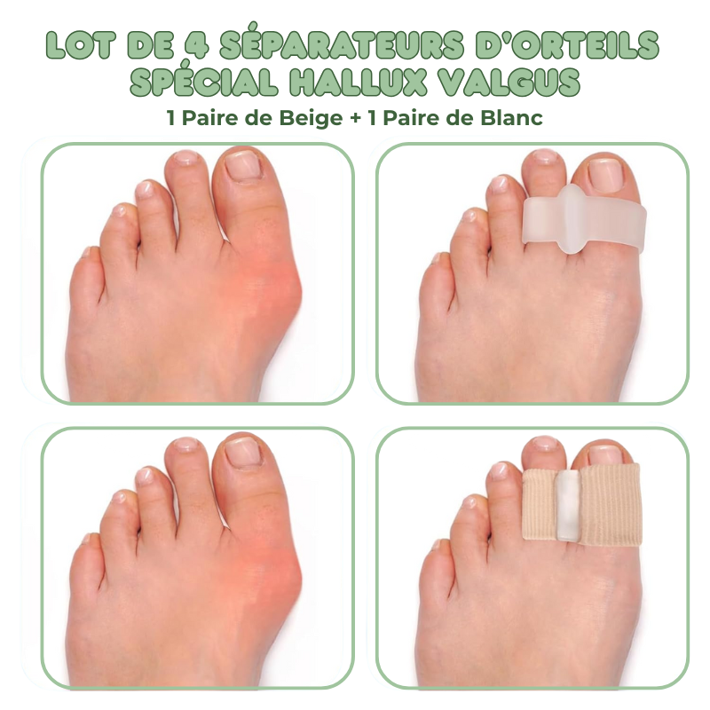 4x Séparateurs d'orteils Spécial Hallux Valgus
