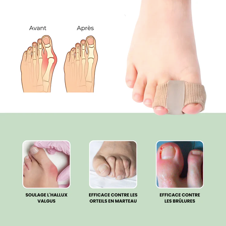 4x Séparateurs d'orteils Spécial Hallux Valgus