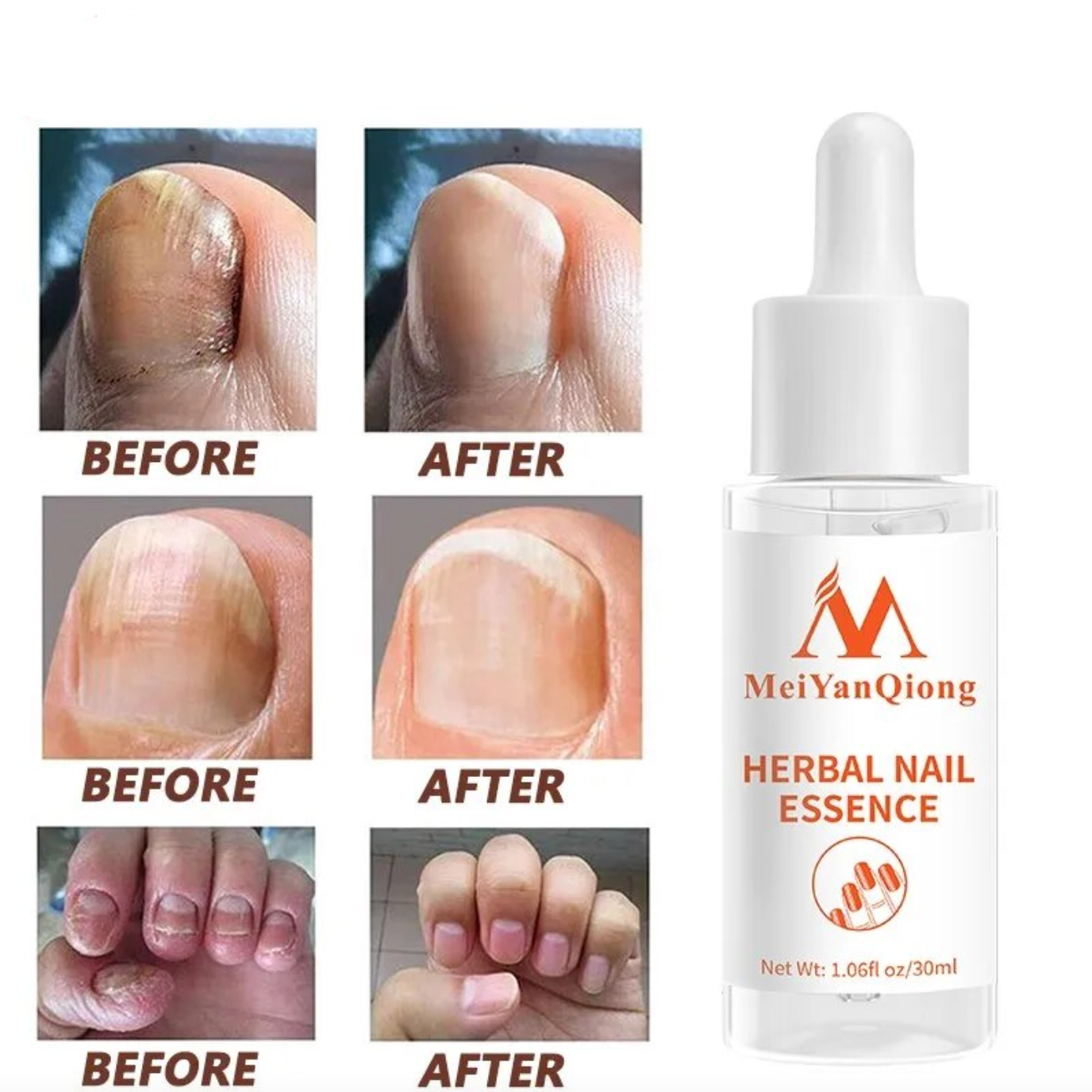 Sérum magique pour les ongles