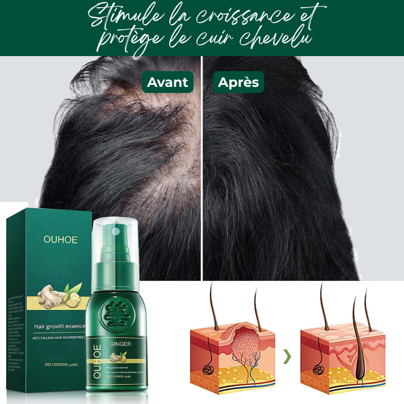 Sérum Capillaire au Gingembre Contre la Perte de Cheveux
