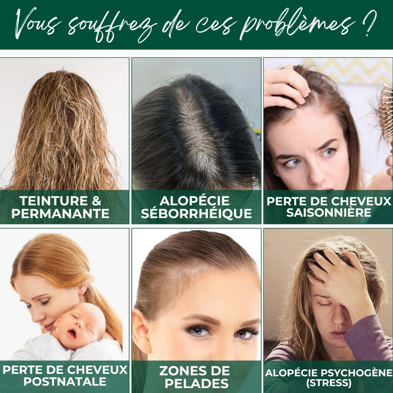 Sérum Capillaire au Gingembre Contre la Perte de Cheveux