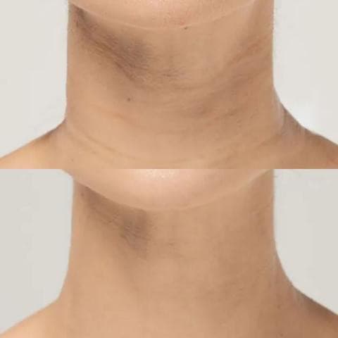 Patchs réutilisables anti-rides - 11 pièces