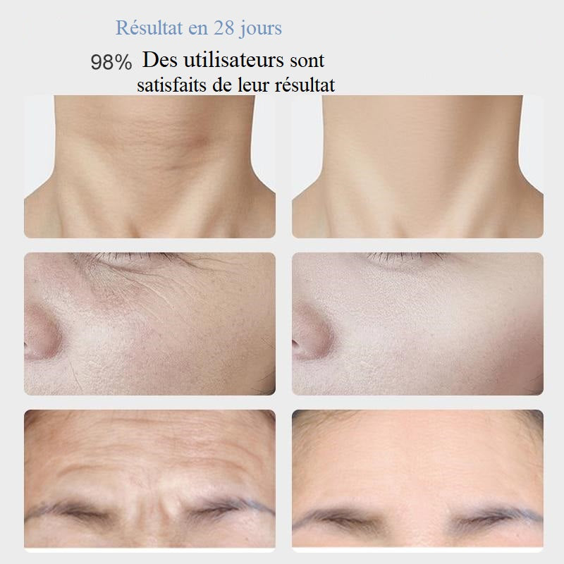masseur-visage-cou-ems