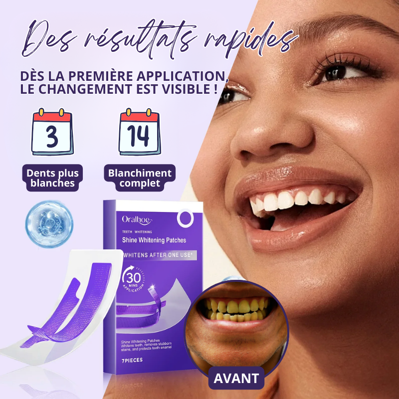 14x Bandes de Blanchiment Dentaire au Gel Violet - EXPRESS' 30min
