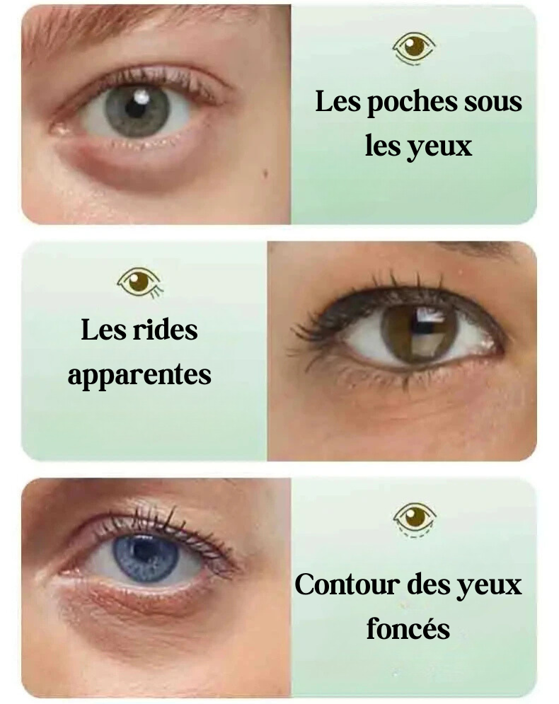 60x Patchs pour les yeux à l'Aloe Vera