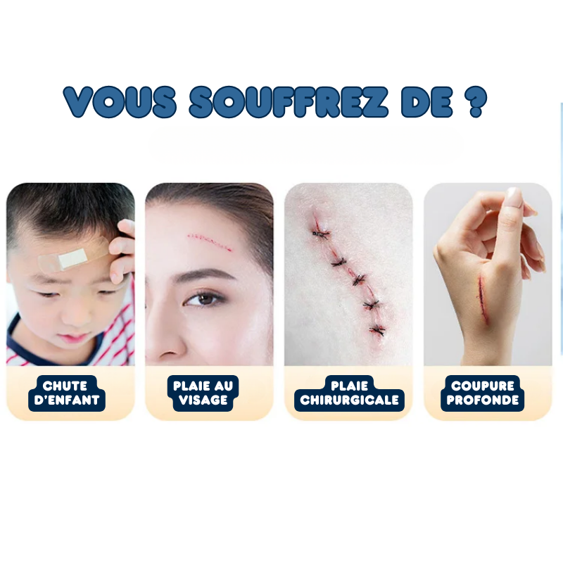 2x Pansements de Suture pour Plaie à Glissière