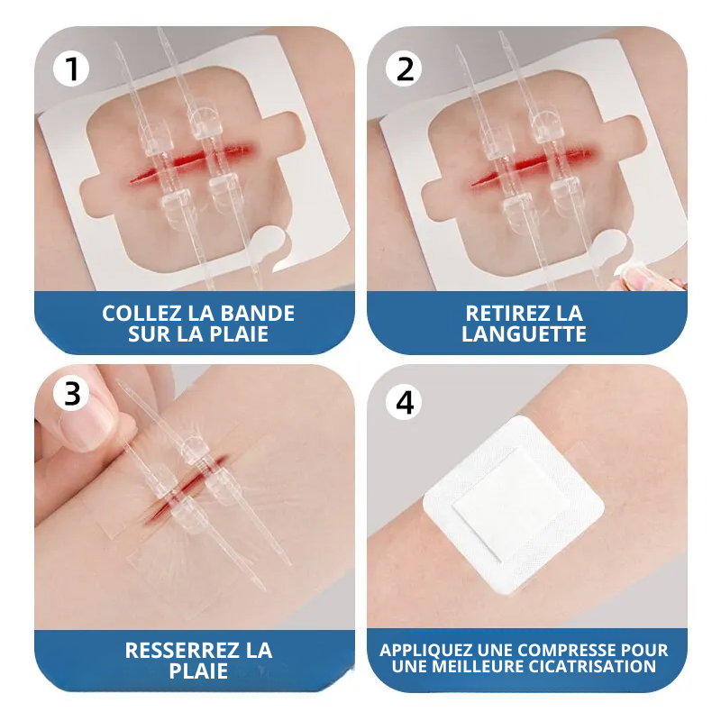 2x Pansements de Suture pour Plaie à Glissière