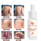 Sérum magique pour les ongles