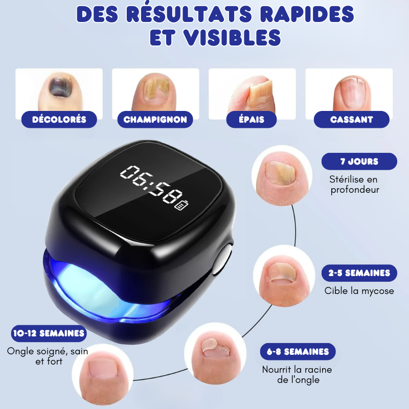 Dispositif de Traitement Laser pour Infections Fongiques