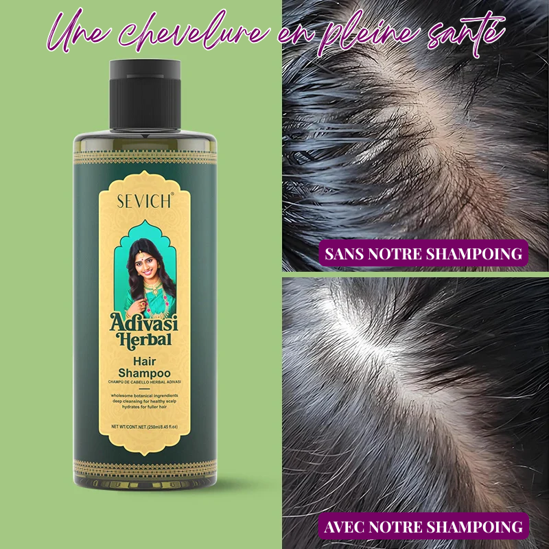 Duo Shampoing & Huile Pousse Accélérée et Anti-Chute - Brosse + Applicateur OFFERTS