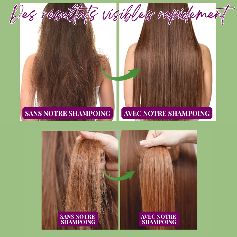 Duo Shampoing & Huile Pousse Accélérée et Anti-Chute - Brosse + Applicateur OFFERTS