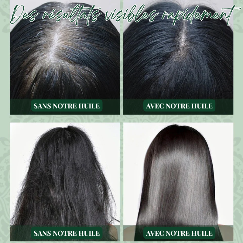 Duo Shampoing & Huile Pousse Accélérée et Anti-Chute - Brosse + Applicateur OFFERTS