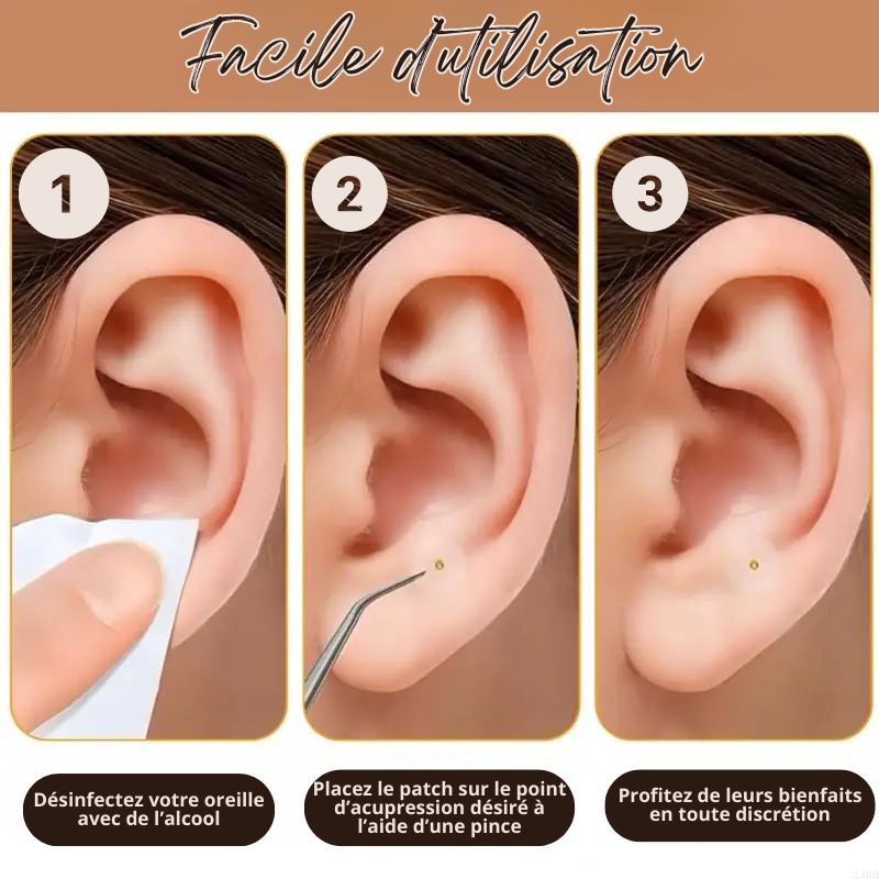 Lot de 100 Patchs Adhésifs d'Acupuncture pour Oreilles - Multiples Bienfaits