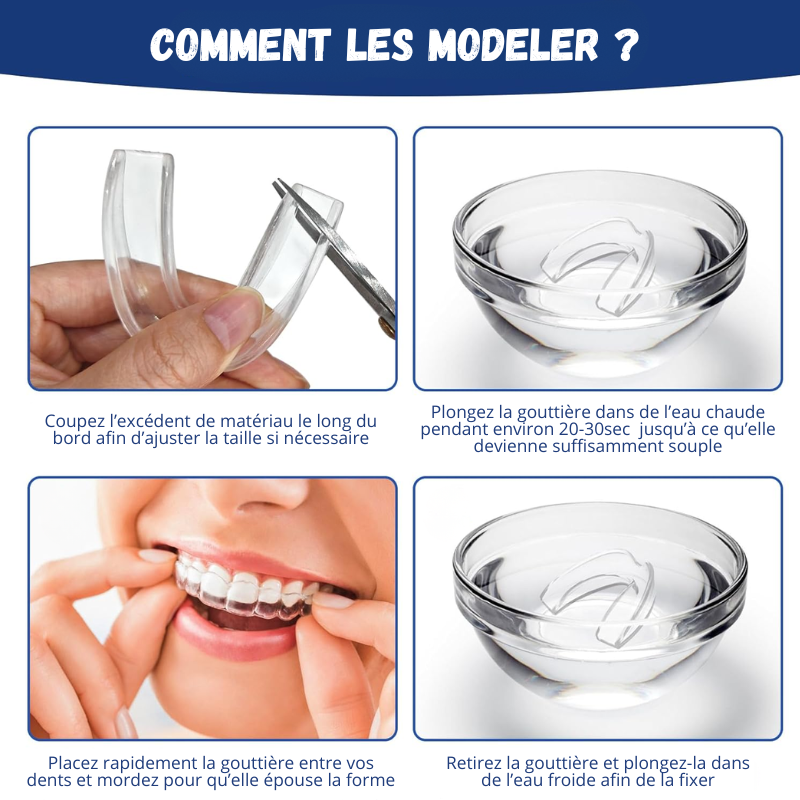 Lot de 4 Gouttières à Modeler Anti-Ronflement