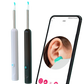 Nettoyeur Auriculaire Connecté – Compatible iOS & Android