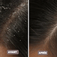 Peigne Anti-Pellicules Auto-nettoyant & Antistatique