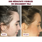 Peigne Thérapeutique Infrarouge Multifonctionnel - Massage du Cuir Chevelu