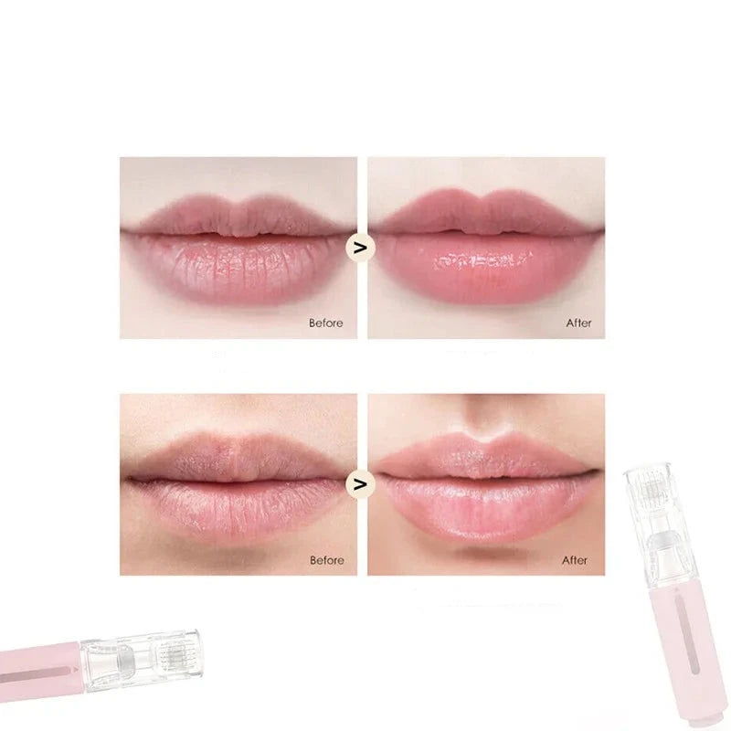 HYDRALIPS - Dermaroller microneedling pour hydrater et repulper vos lèvres