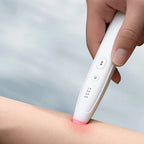 Stylo Anti-démangeaisons à 4 Températures contre les piqûres de moustiques