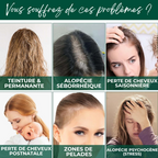 Sérum Capillaire au Gingembre Contre la Perte de Cheveux