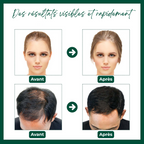 Sérum Capillaire au Gingembre Contre la Perte de Cheveux