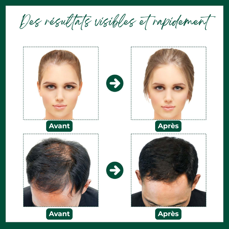 Sérum Capillaire au Gingembre Contre la Perte de Cheveux