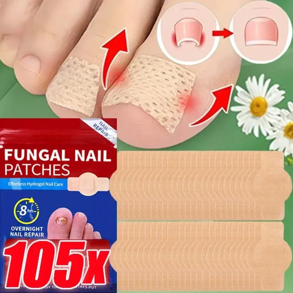 Lot de 42 Patchs Anti-Mycose, Champignons & Incarnation pour Ongles