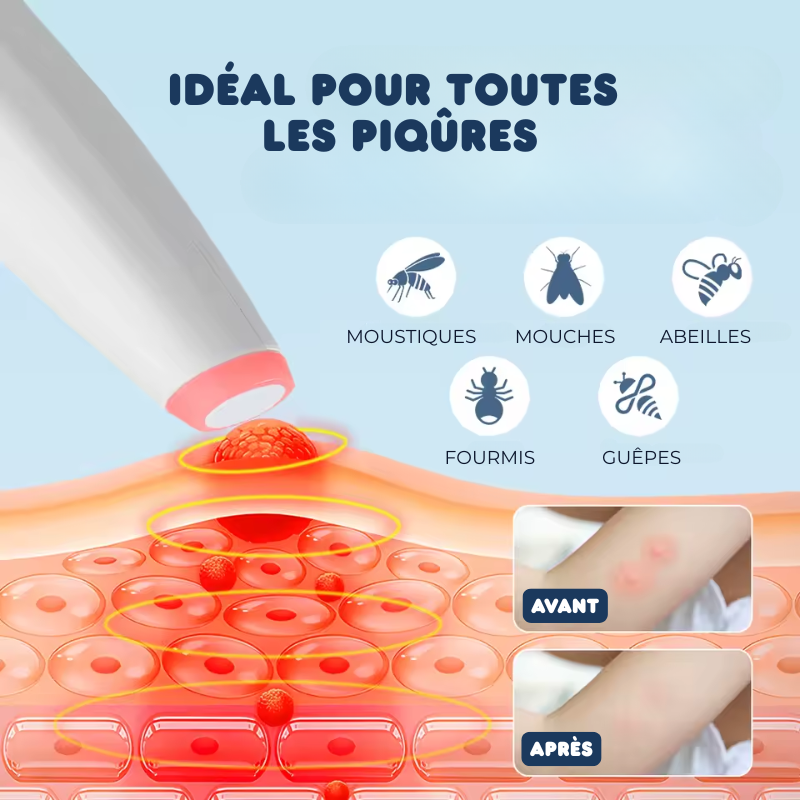 Stylo Anti-démangeaisons à 4 Températures contre les piqûres de moustiques