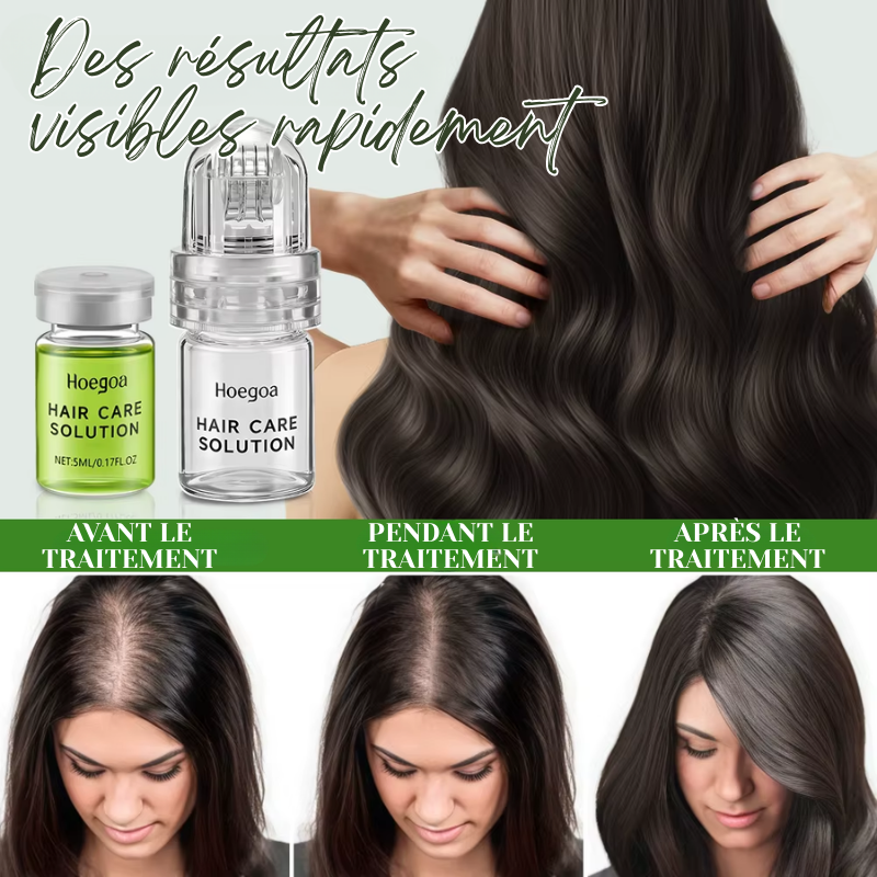 Coffret Ampoules Capillaire Anti-Perte de Cheveux + Dermaroller à Réservoir OFFERT
