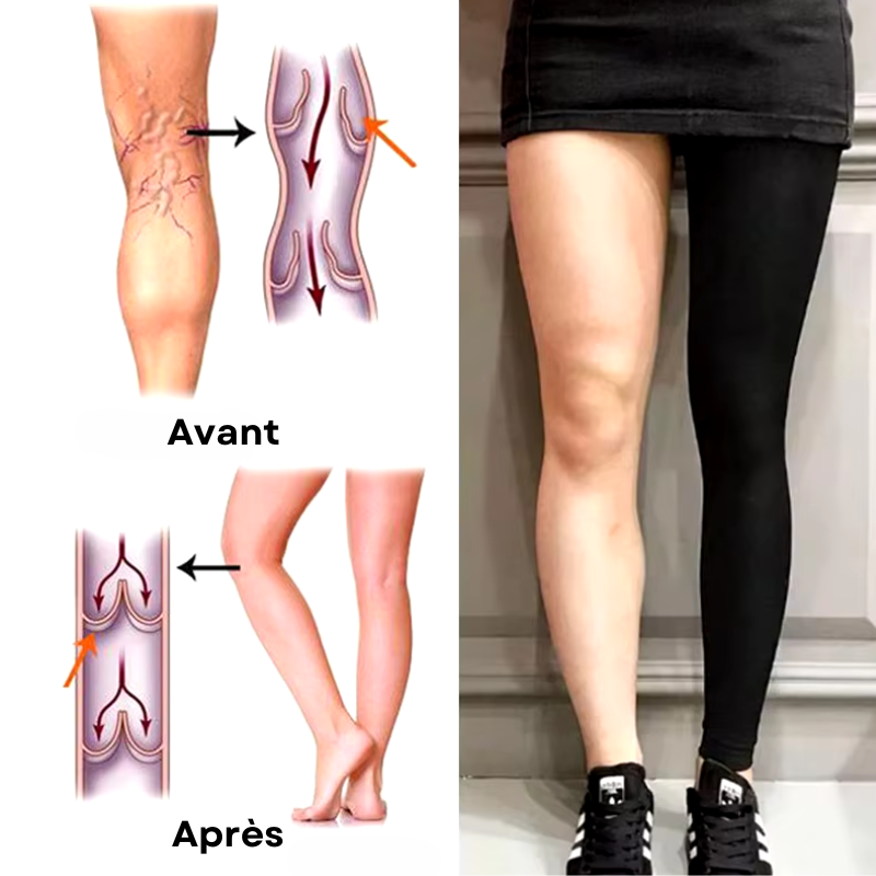 Legging de compression anti-cellulite & amincissant