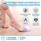 Appareil de traitement au laser pour champignon des ongles