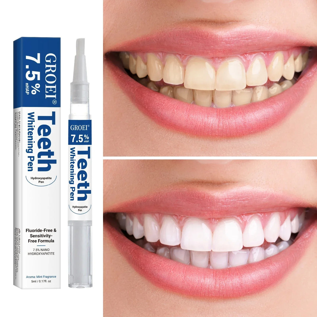 Magic teeth whitening pen