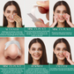 NASAL STRIPS - 30x Bandes Nasales Anti-Ronflement