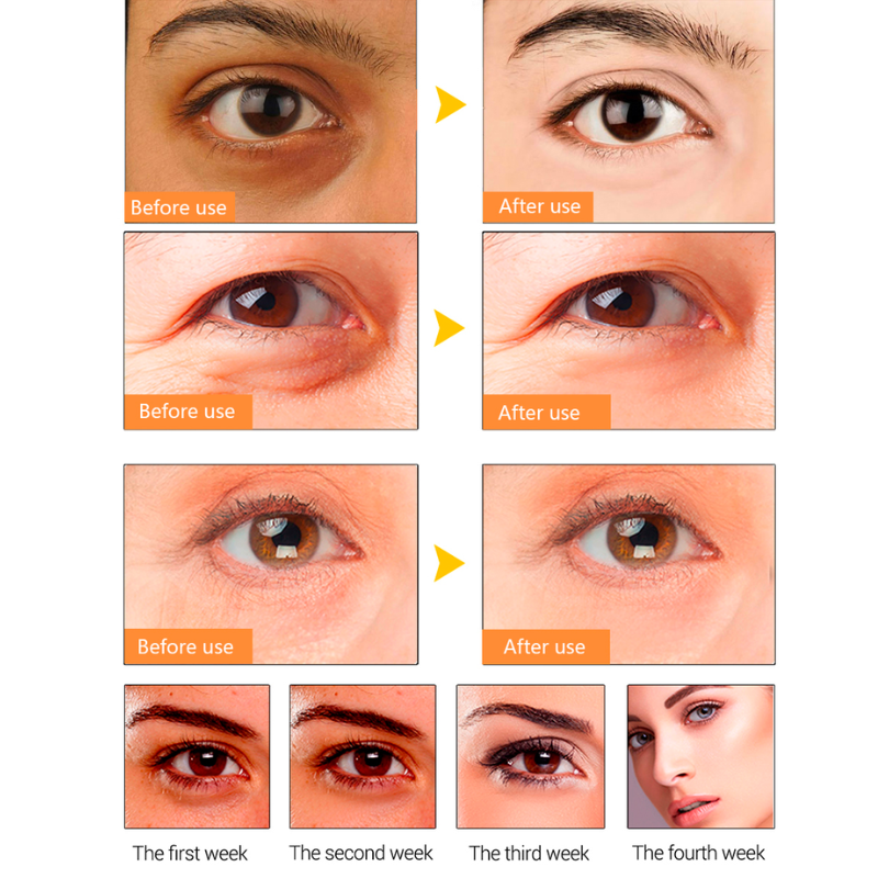 20x Patchs yeux anti-cernes Or Collagène & Acide Hyaluronique