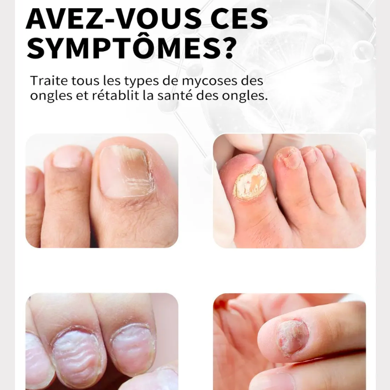 Sérum magique pour les ongles
