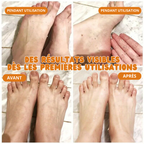 Spray Exfoliant pour Pieds à l'huile d'Orange