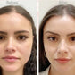 Face Lift - Adhésifs lifting invisible naturel