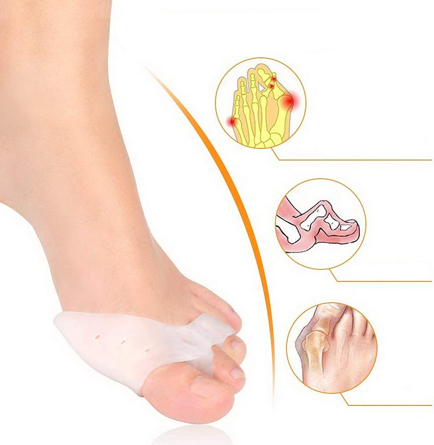 Paire de Correcteur Hallux Valgus en Silicone