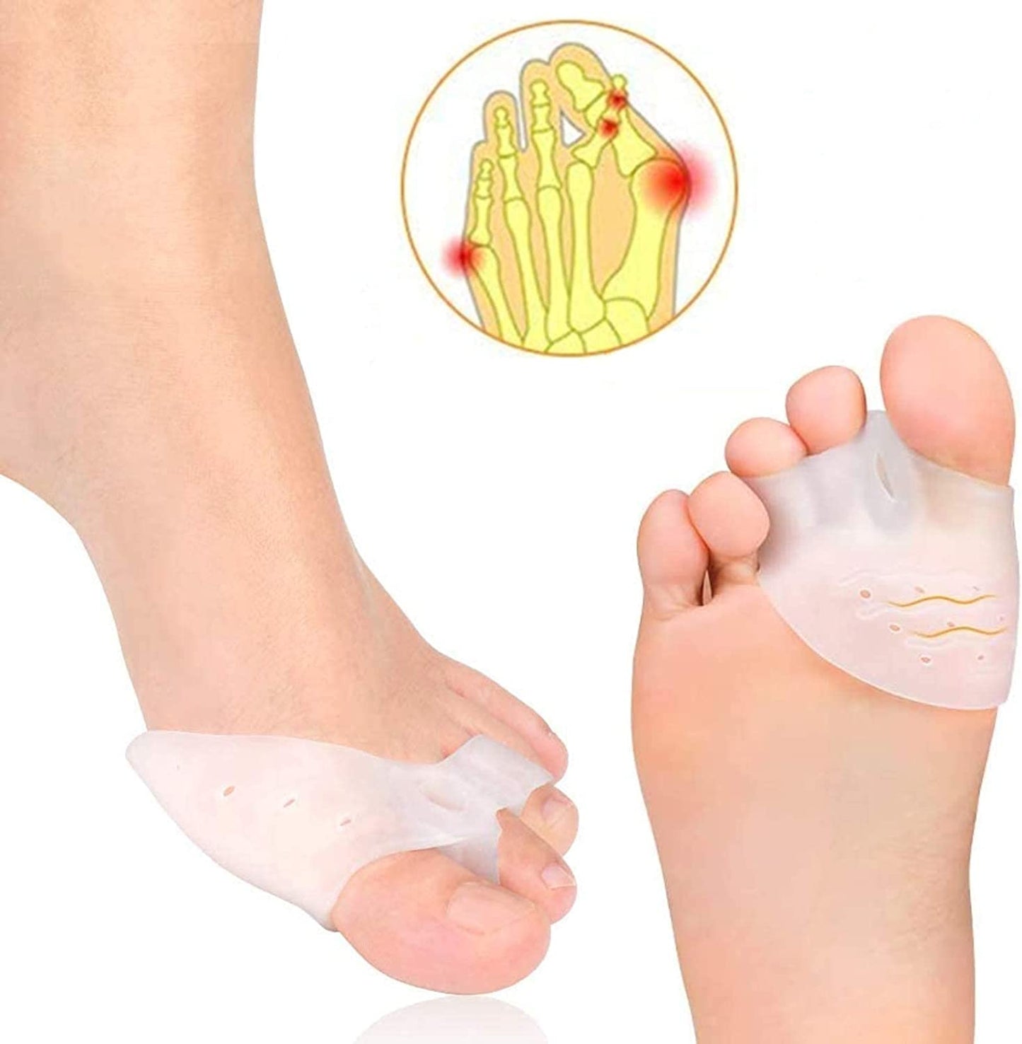 Paire de Correcteur Hallux Valgus en Silicone