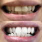 Stylo magique dents blanches