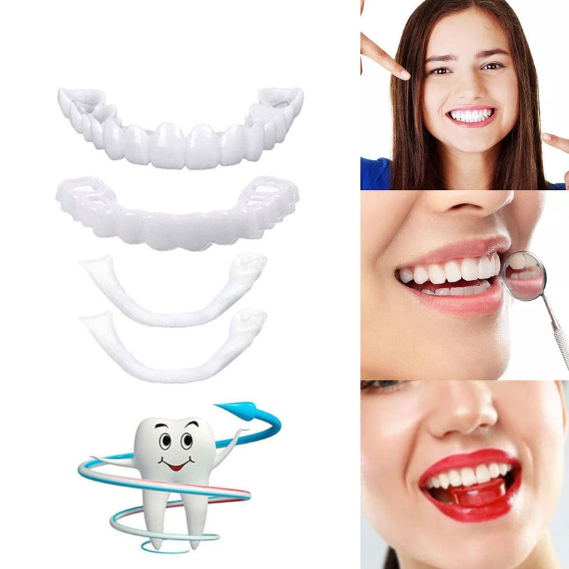 Des facettes dentaires pour un sourire radieux