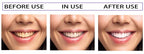 MAGIC SMILE - Dentifrice blanchissant