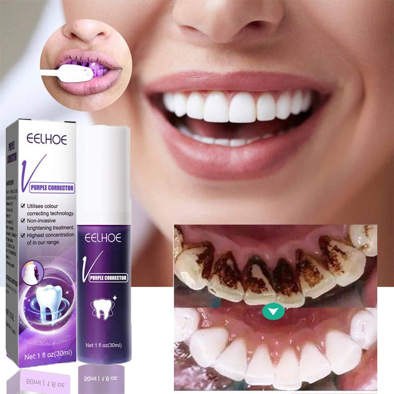 MAGIC SMILE - Dentifrice blanchissant