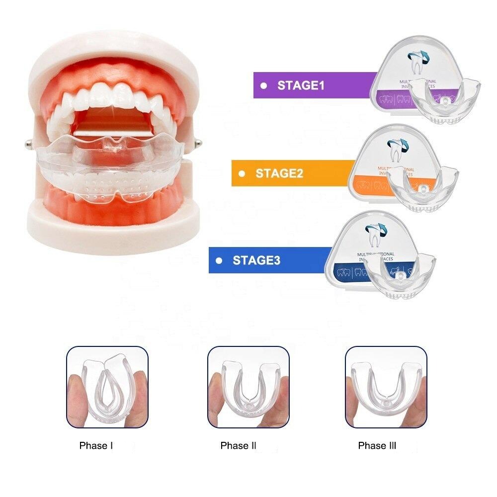 Pack de 3 Gouttières d'alignement dentaire - La Boutique de la Santé