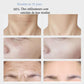masseur-visage-cou-ems
